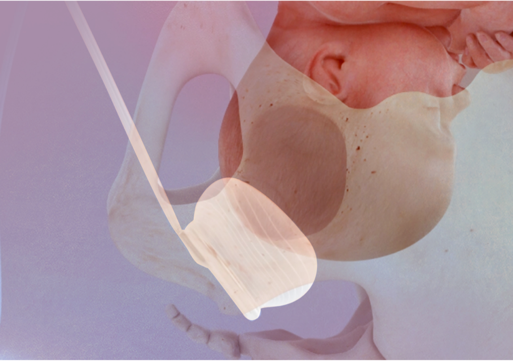 CooperSurgical InService